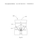 Computer Based Models for Absorbent Articles diagram and image