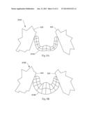 Computer Based Models for Absorbent Articles diagram and image