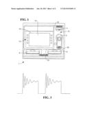 FOREIGN BODY DETECTING diagram and image