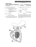 GUITAR PICK HOLDER ORNAMENT diagram and image