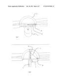 Fender Assembly for Boats diagram and image