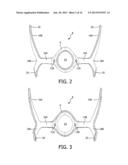 PATIENT INTERFACE DEVICE WITH A FRAME ASSEMBLY HAVING A DOUBLE-Y     SUPPORTING STRUCTURE diagram and image