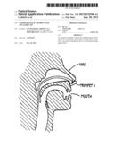 Nasopharyngeal Trumpet with Inflatable Tip diagram and image