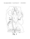 PORTABLE ENCLOSURE WITH ELASTICALLY SEALED OPENING diagram and image