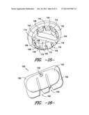 ADHESIVE PLUG FOR THIN FILM PHOTOVOLTAIC DEVICES AND THEIR METHODS OF     MANUFACTURE diagram and image