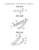 DEVICES AND METHODS FOR ENDOLUMINAL PLICATION diagram and image