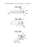 DEVICES AND METHODS FOR ENDOLUMINAL PLICATION diagram and image