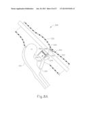 FEATURE TO REENGAGE SAFETY SWITCH OF TISSUE STAPLER diagram and image