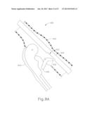 FEATURE TO REENGAGE SAFETY SWITCH OF TISSUE STAPLER diagram and image