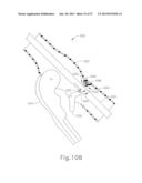 FEATURE TO REENGAGE SAFETY SWITCH OF TISSUE STAPLER diagram and image