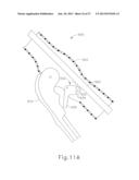 FEATURE TO REENGAGE SAFETY SWITCH OF TISSUE STAPLER diagram and image