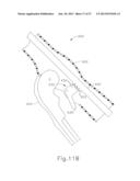 FEATURE TO REENGAGE SAFETY SWITCH OF TISSUE STAPLER diagram and image