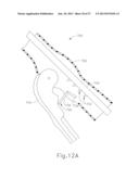 FEATURE TO REENGAGE SAFETY SWITCH OF TISSUE STAPLER diagram and image