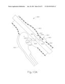 FEATURE TO REENGAGE SAFETY SWITCH OF TISSUE STAPLER diagram and image