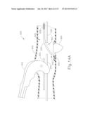 FEATURE TO REENGAGE SAFETY SWITCH OF TISSUE STAPLER diagram and image