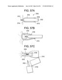 DEVICES AND METHODS FOR ENDOLUMINAL PLICATION diagram and image