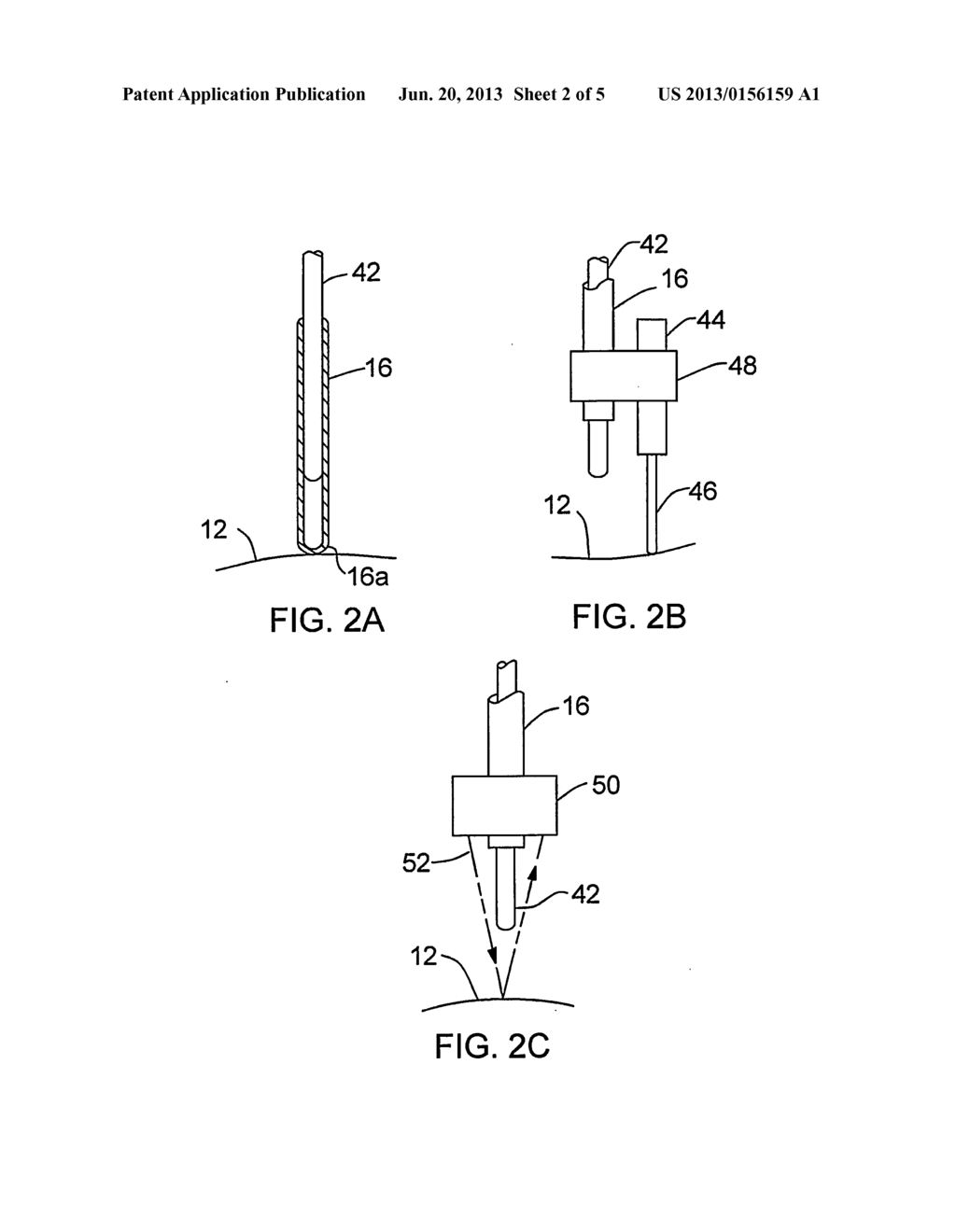 APPARATUS AND METHODS FOR RADIATION TREATMENT OF TISSUE SURFACES - diagram, schematic, and image 03