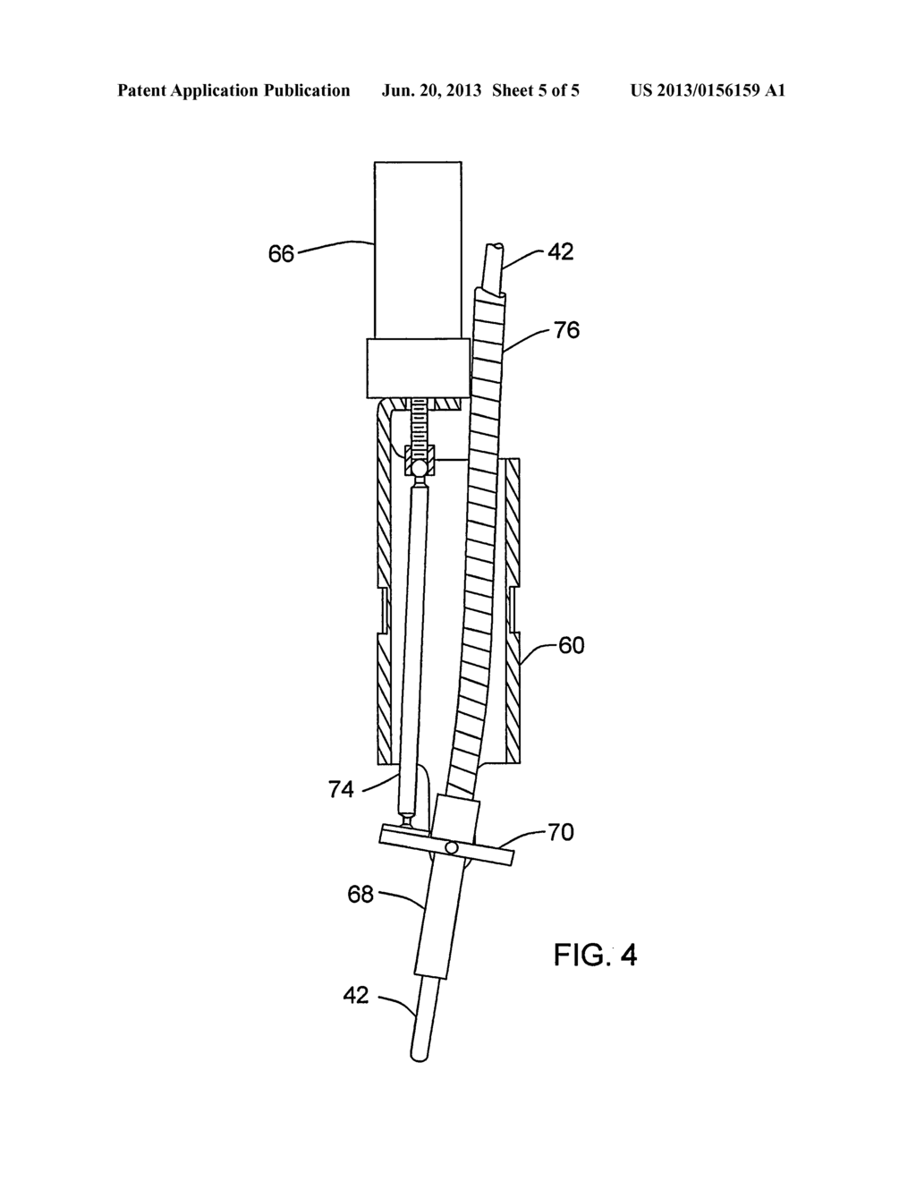 APPARATUS AND METHODS FOR RADIATION TREATMENT OF TISSUE SURFACES - diagram, schematic, and image 06