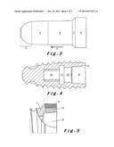 IMPLANT DENTAIRE diagram and image