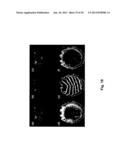 Systems and Methods for Magnetic Resonance Imaging diagram and image