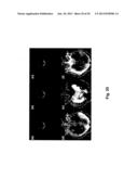 Systems and Methods for Magnetic Resonance Imaging diagram and image