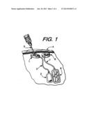 Subcutaneous Controlled Delivery System For The Topical Administration Of     Drugs, Biological Agents Or Therapeutic Agents To Targeted Areas Within     The Body diagram and image