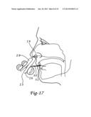 Intranasal Cartridge Devices diagram and image