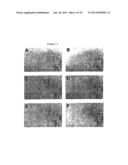 METHOD OF INHIBITING ANGIOGENESIS OR INVASION OR FORMATION OF METASTASES diagram and image