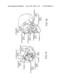 DEVICES, SYSTEMS AND METHODS FOR TREATMENT OF NEUROPSYCHIATRIC DISORDERS diagram and image