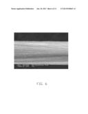 PACEMAKERS AND PACEMAKER ELECTRODES diagram and image