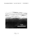 PACEMAKERS AND PACEMAKER ELECTRODES diagram and image