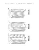 Porous Bidirectional Bellowed Tracheal Reconstruction Device diagram and image