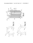 Porous Bidirectional Bellowed Tracheal Reconstruction Device diagram and image