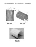 Porous Bidirectional Bellowed Tracheal Reconstruction Device diagram and image