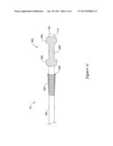 HEART VALVE REPLACEMENT CATHETER diagram and image