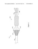 HEART VALVE REPLACEMENT CATHETER diagram and image