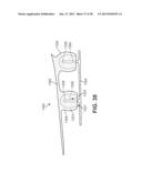 ARTICLE OF FOOTWEAR HAVING AN ELEVATED PLATE SOLE STRUCTURE diagram and image