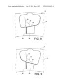 AERODYNAMIC SHROUD FOR THE BACK OF A COMBUSTION CHAMBER OF A TURBOMACHINE diagram and image