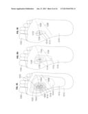 METHODS AND APPARATUS FOR IMAGING, DETECTING, AND MONITORING SURFICIAL AND     SUBDERMAL INFLAMMATION diagram and image