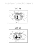 OPHTHALMOLOGIC APPARATUS, AND OPHTHALMOLOGIC METHOD AND PROGRAM diagram and image