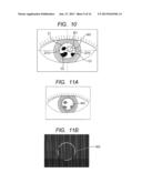 OPHTHALMOLOGIC APPARATUS, AND OPHTHALMOLOGIC METHOD AND PROGRAM diagram and image