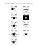 OPHTHALMOLOGIC APPARATUS, AND OPHTHALMOLOGIC METHOD AND PROGRAM diagram and image