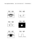 OPHTHALMOLOGIC APPARATUS, AND OPHTHALMOLOGIC METHOD AND PROGRAM diagram and image