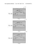 SYSTEM AND METHOD FOR AUTO-FOCUSING IN OPTICAL COHERENCE TOMOGRAPHY diagram and image