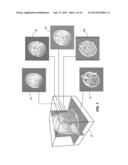 AC-PC SEGMENTATION SYSTEM AND METHOD diagram and image