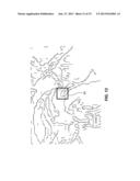 AC-PC SEGMENTATION SYSTEM AND METHOD diagram and image