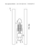 THERAPEUTIC AGENT PREPARATIONS FOR DELIVERY INTO A LUMEN OF THE INTESTINAL     TRACT USING A SWALLOWABLE DRUG DELIVERY DEVICE diagram and image