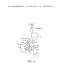 THERAPEUTIC AGENT PREPARATIONS FOR DELIVERY INTO A LUMEN OF THE INTESTINAL     TRACT USING A SWALLOWABLE DRUG DELIVERY DEVICE diagram and image