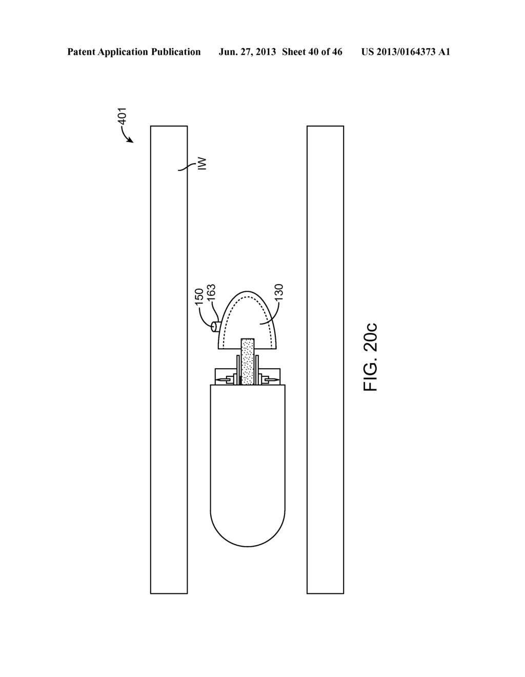 THERAPEUTIC AGENT PREPARATIONS FOR DELIVERY INTO A LUMEN OF THE INTESTINAL     TRACT USING A SWALLOWABLE DRUG DELIVERY DEVICE - diagram, schematic, and image 41