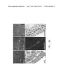 LIPIDS, LIPID COMPLEXES AND USE THEREOF diagram and image